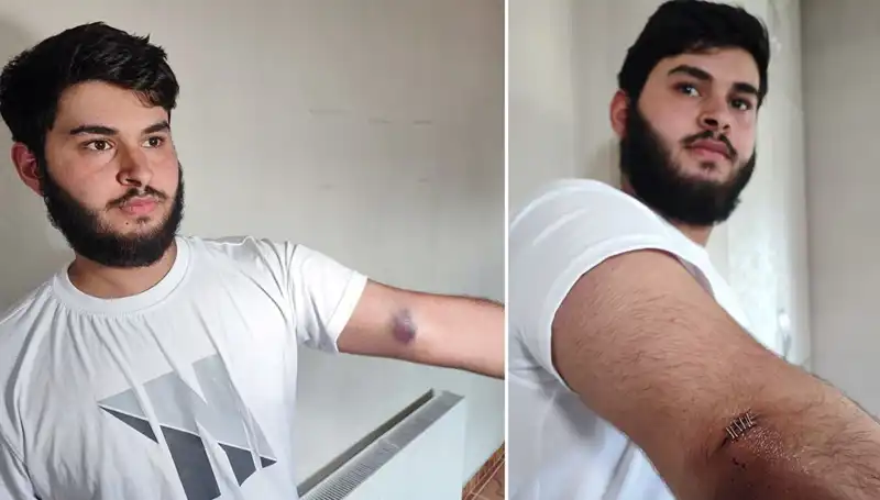 Bahçeye Kaçan Top, Mahallede Gözler Önünde İnanılmaz Bir Kaosa Yol Açtı!